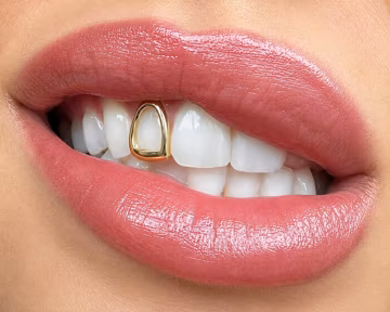 Single Tooth Gold Grill, Open Face Tooth Cap, Custom Gold Tooth Cover, Minimalist Hip Hop Dental Jewelry, Removable Grill